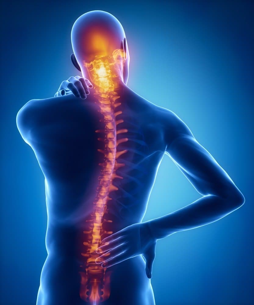 Spinal injury pain in sacral cervical region.