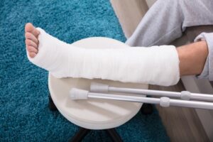 broken leg in cast